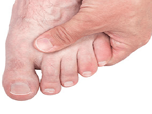 Болят пальцы ног: в чем причины