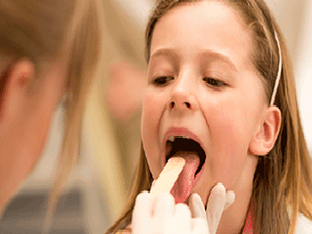 Как лечить хронический тонзиллит у ребенка