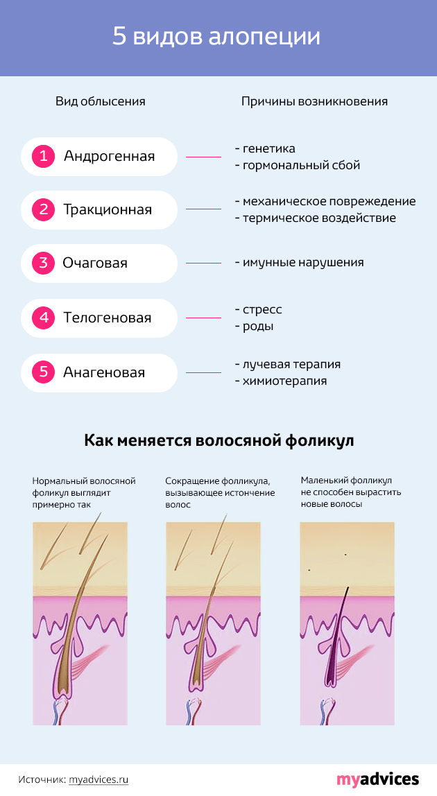 Причина выпадения волос на голове у женщины