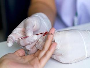 Гемоглобин в крови у мужчин: норма и причины отклонений