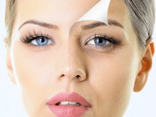 Как убрать гусиные лапки вокруг глаз — самые эффективные способы