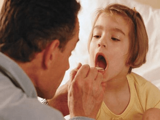 Как распознать грибковую ангину у ребенка