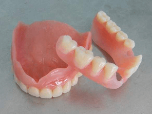 Нейлоновые зубные протезы: что это такое