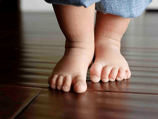Как определить плоскостопие у ребенка