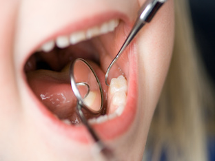 Кариес молочных зубов: стоит ли лечить