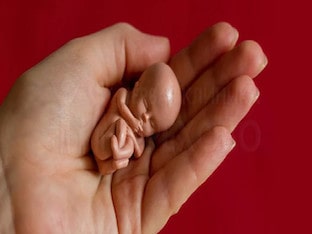Аборт: виды абортов, осложнения после аборта