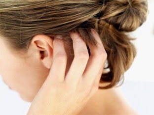 Как проявляется псориаз на голове, чем лечить