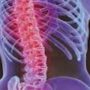 Остеохондроз: что это такое и чем его лечить?