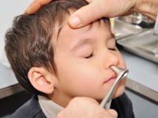 Полипы в носу у ребенка: как лечить