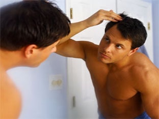 Почему лысеет мужчина, средство от облысения