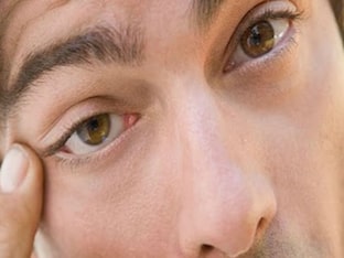 Что делать, когда дергается глаз: причины, лечение и профилактика