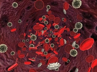 Что такое анемия, от чего она развивается?