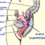 Что такое эндометриоз, чем он опасен?