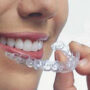 Прозрачные брекеты, какие они?