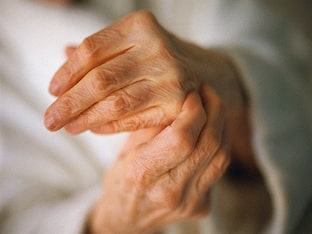 Как вылечить артрит пальцев рук