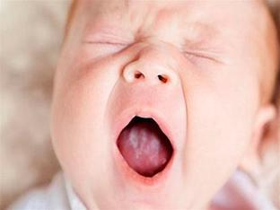 Чем лечить молочницу у ребенка во рту