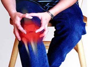 Как распознать артроз коленного сустава