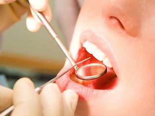 Как удалить зубной камень и почему он появляется