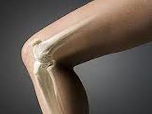 Народное лечение артроза коленного сустава (гонартроза)