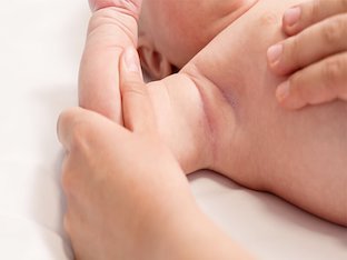 Опрелости у ребенка: как лечить пеленочный дерматит
