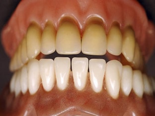 Почему изменяется цвет зубной эмали