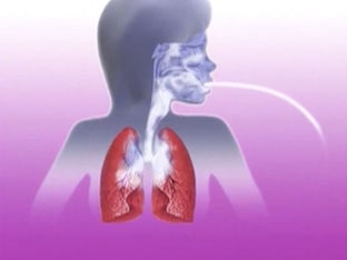 Профилактика приступов бронхиальной астмы: проще предупредить, чем лечить