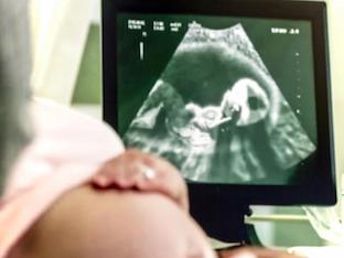 Ребёнок икает в животе при беременности: почему это происходит