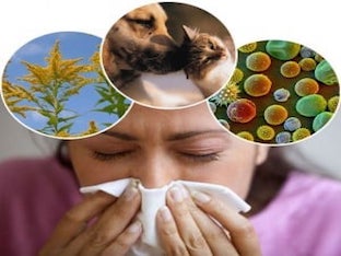Какие симптомы аллергического ринита, лечение