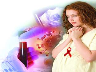 Симптомы ВИЧ-инфекции у женщин и мужчин