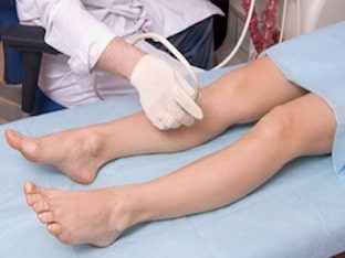 Возможно ли вылечить варикоз на ногах без операции