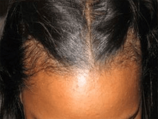 От чего выпадают волосы: советы и рекомендации