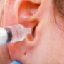 Можно ли перекисью водорода чистить уши