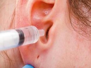 Можно ли перекисью водорода чистить уши