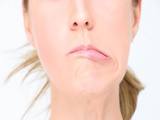 Можно ли вылечить невралгии лицевого нерва без уколов